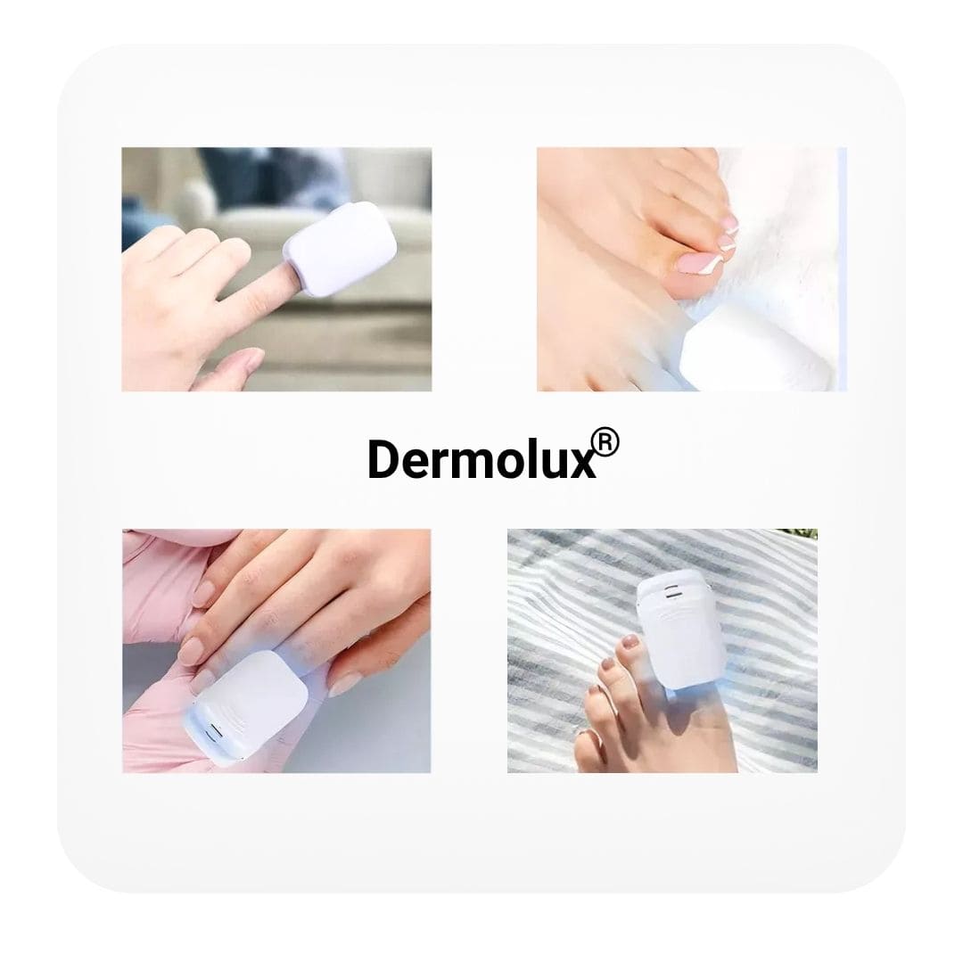 Dermolux® (Dispositivo láser para tratamiento de hongos en las uñas)