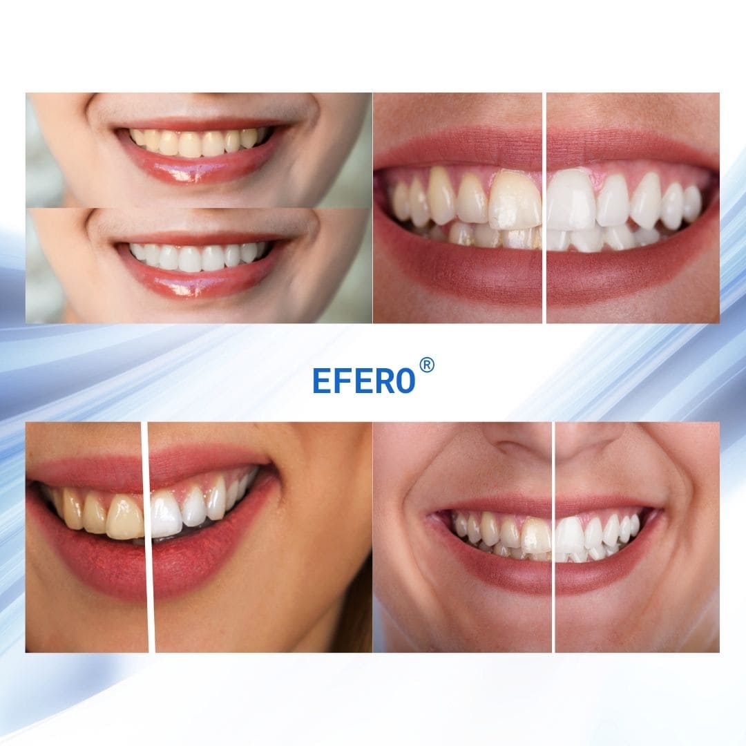EFERO® (Lápiz blanqueador dental)