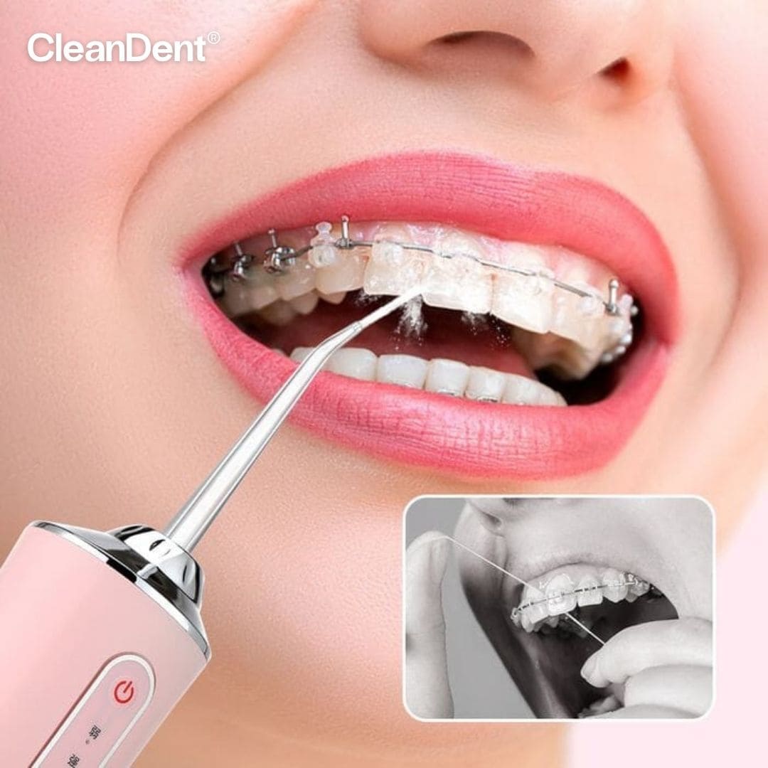 CleanDent® (Irrigador Bucal Limpiador de Dientes)
