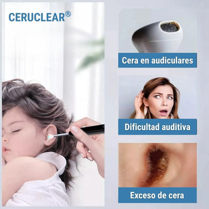 CeruClear® (Limpiador de Oídos Con Cámara Endoscopio)