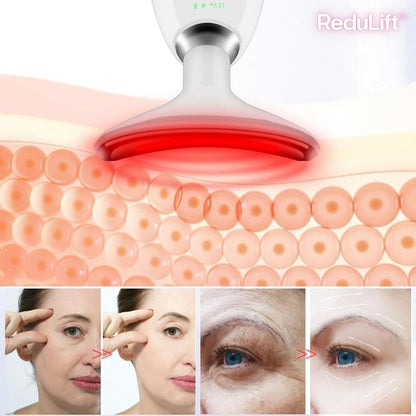 ReduLift® (Masajeador Reductor Papada)
