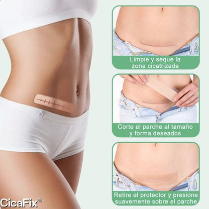 CicaFix® 2 X 1 (Parche Silicon Quita Cicatrices)