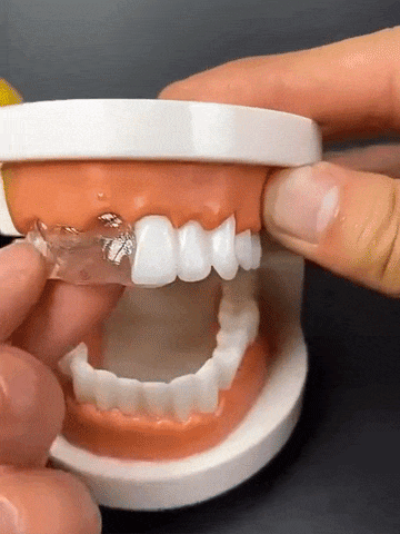 FALSE TEETH® 2X1 (Dientes postizos)