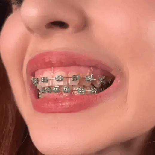 CleanDent® (Irrigador Bucal Limpiador de Dientes)