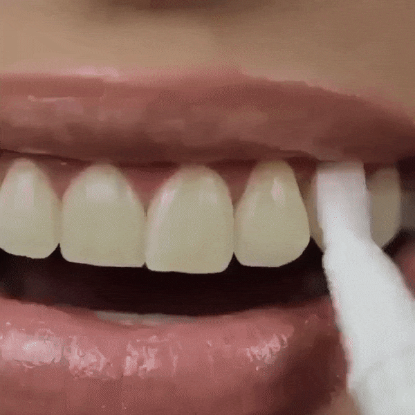 EFERO® (Lápiz blanqueador dental)